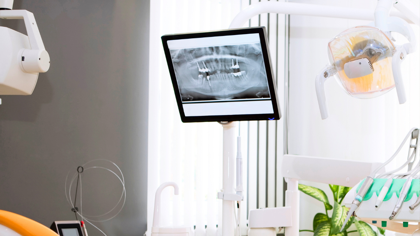 デジタルレントゲン